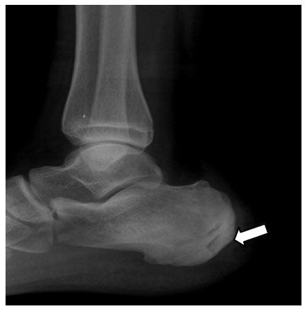Thyroid tumors the new criteria for intervention on diagnosis surgery and therapy